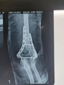 Bone Joint And Spine Clinic 2