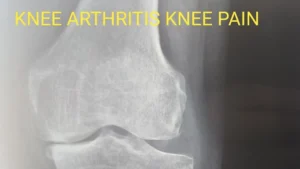 Dr. Bageja ortho & Knee Clinic 1