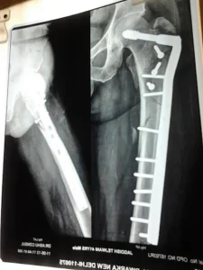 The Neo Orthopaedic Clinic 1