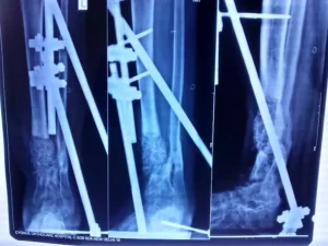 The Neo Orthopaedic Clinic 3